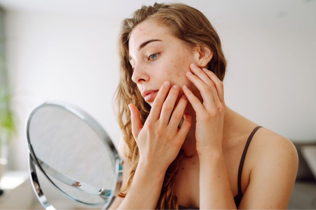 Select Rooibos for Skin: The South African Secret Hiding in Your Teacup Rooibos for Skin: The South African Secret Hiding in Your Teacup - rooibos for sensitive skin